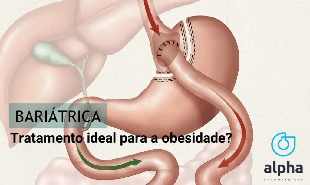 Cirurgia bariátrica