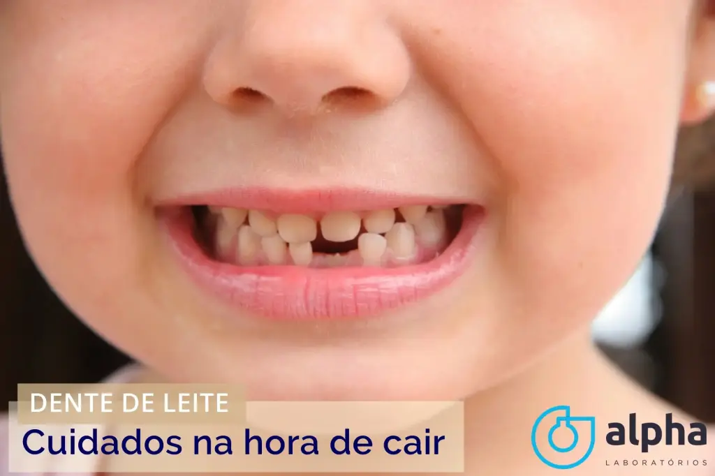 Dentes de leite