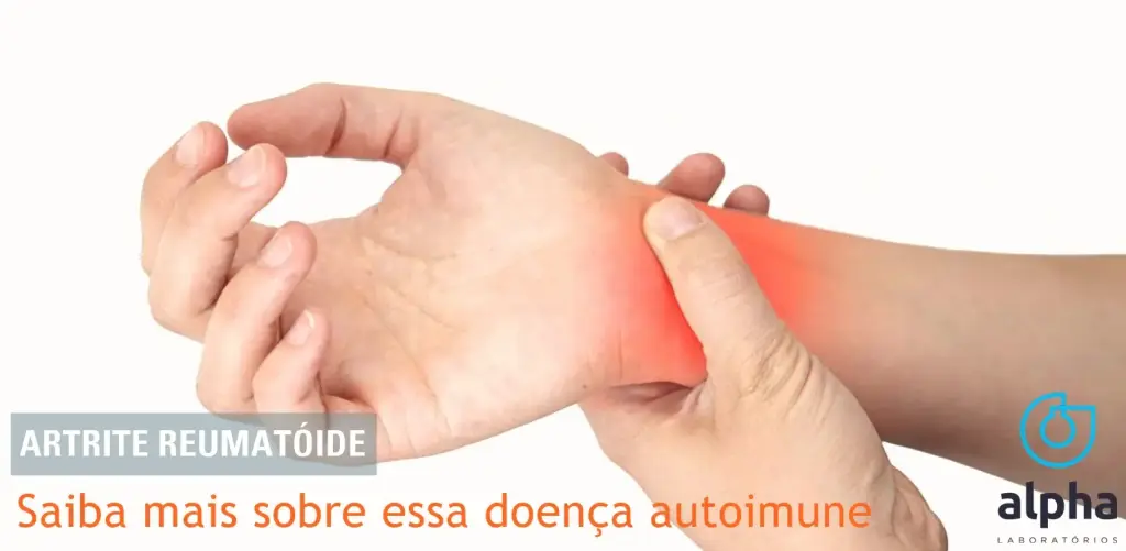 SAIBA MAIS SOBRE A ARTRITE REUMATÓIDE