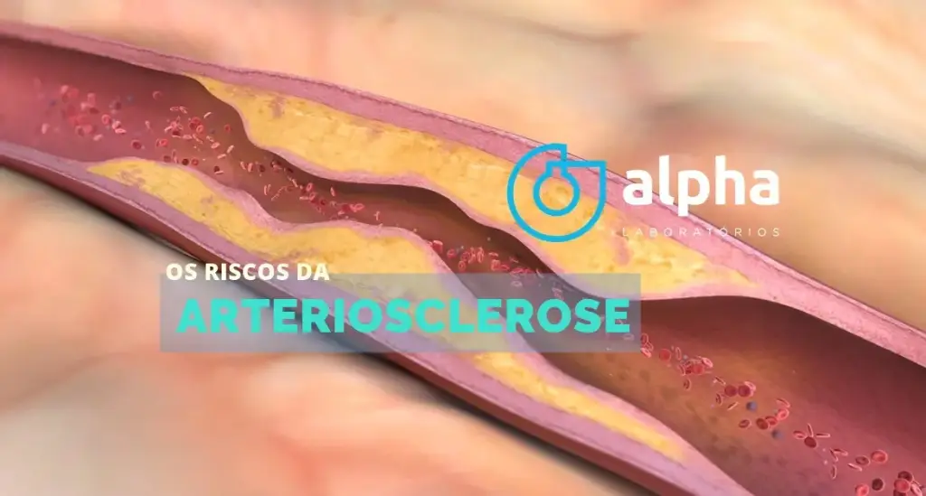 ARTERIOSCLEROSE
