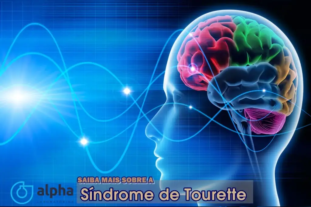 SÍNDROME DE TOURETTE