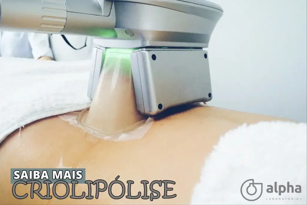 CRIOLIPÓLISE