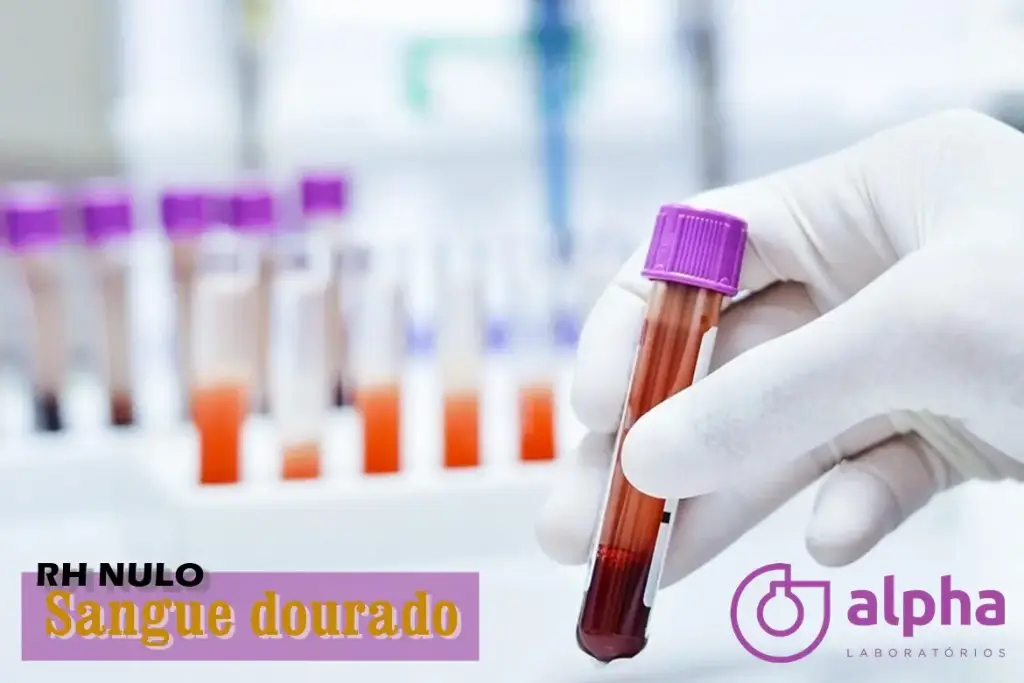 SANGUE DOURADO