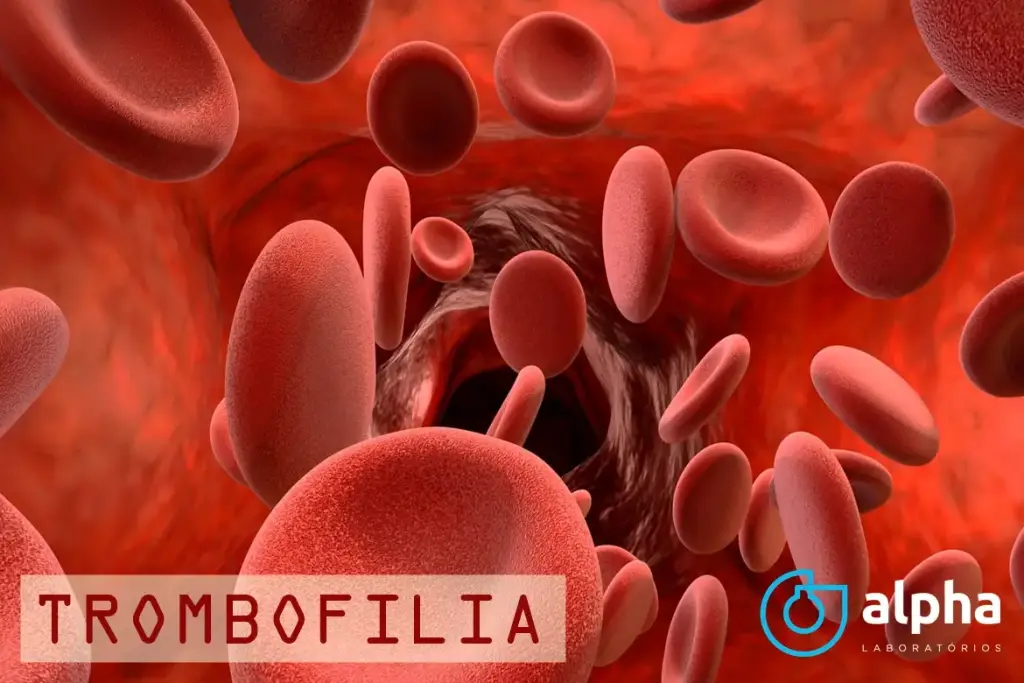TROMBOFILIA