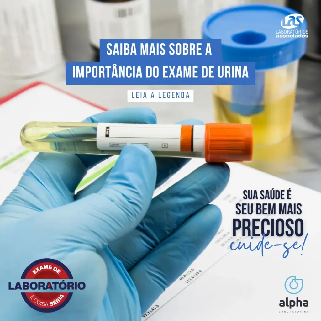 EXAME DE URINA: QUAL A SUA IMPORTÂNCIA??